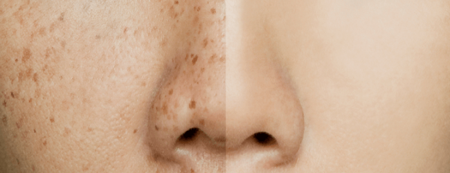 Medium Photo Retouching Service Medium Photo Retouching Service