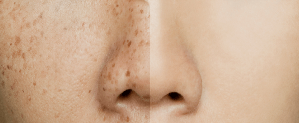 Medium Photo Retouching Service (1) Medium Photo Retouching Service (1)