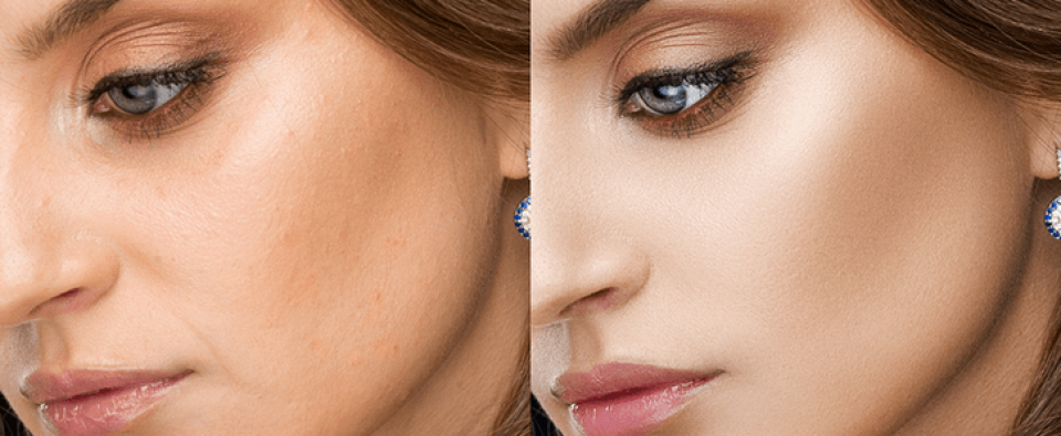 Medium Photo Retouching Service (2) Medium Photo Retouching Service (2)