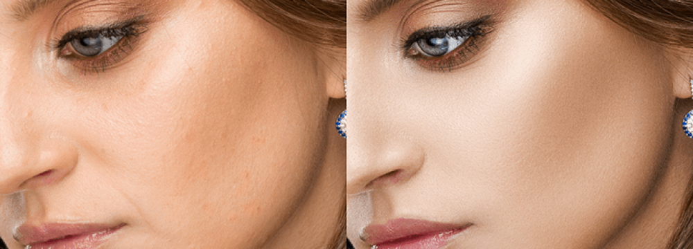 Medium Photo Retouching Service Medium Photo Retouching Service